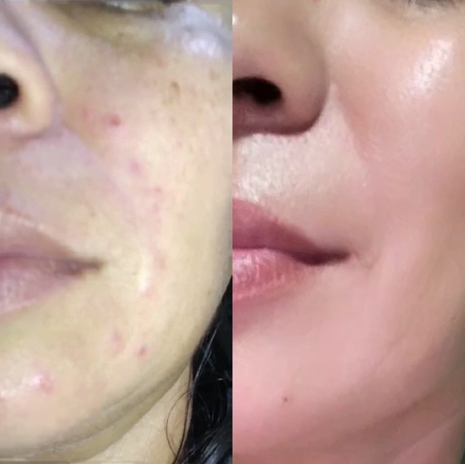 Testimonial María 01- Evanna Purity